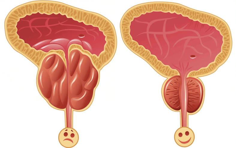 the cause of potency problems in men